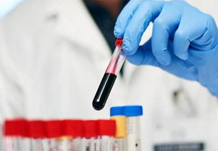 Mengenal Toksikologi dan Apa yang Dipelajari