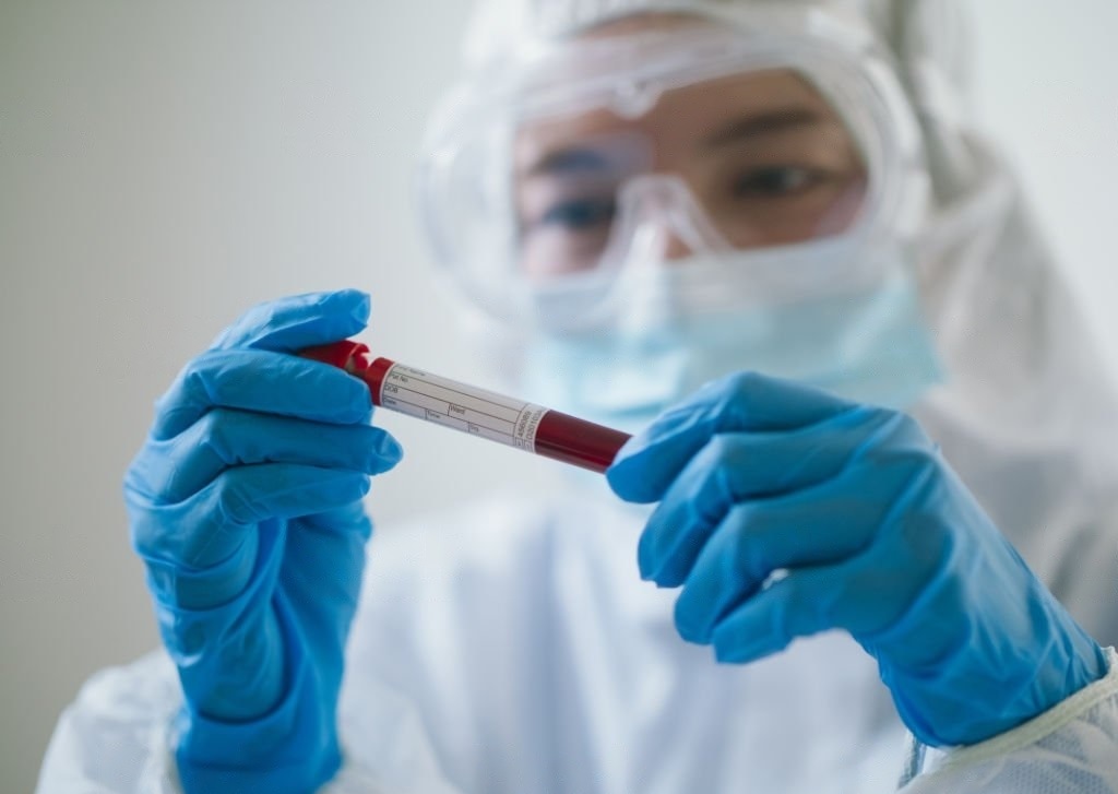 Ketahui Fungsi Penting Tes Hematologi