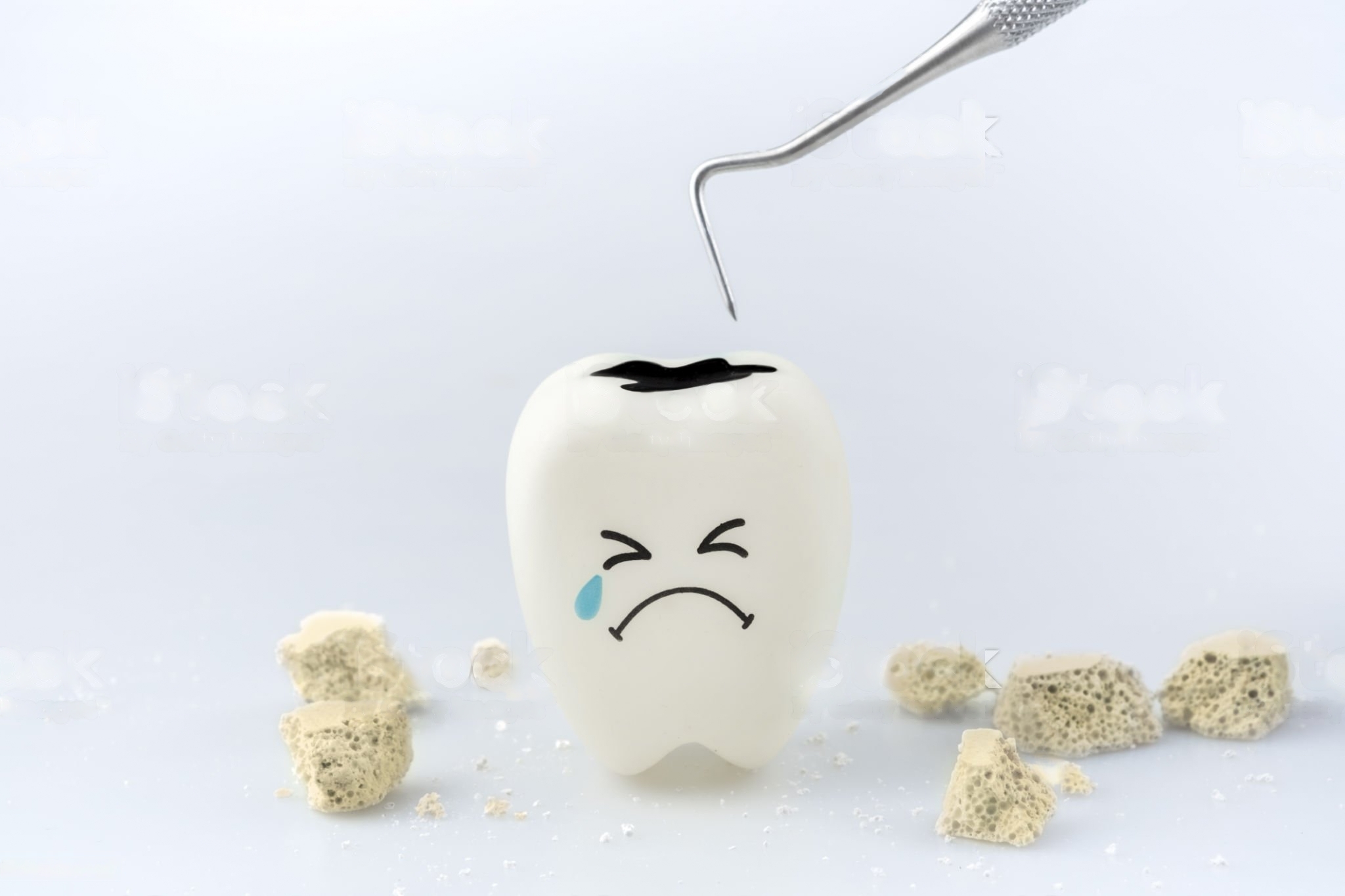 Fakta Penyebab Gigi Berlubang Terasa Sakit