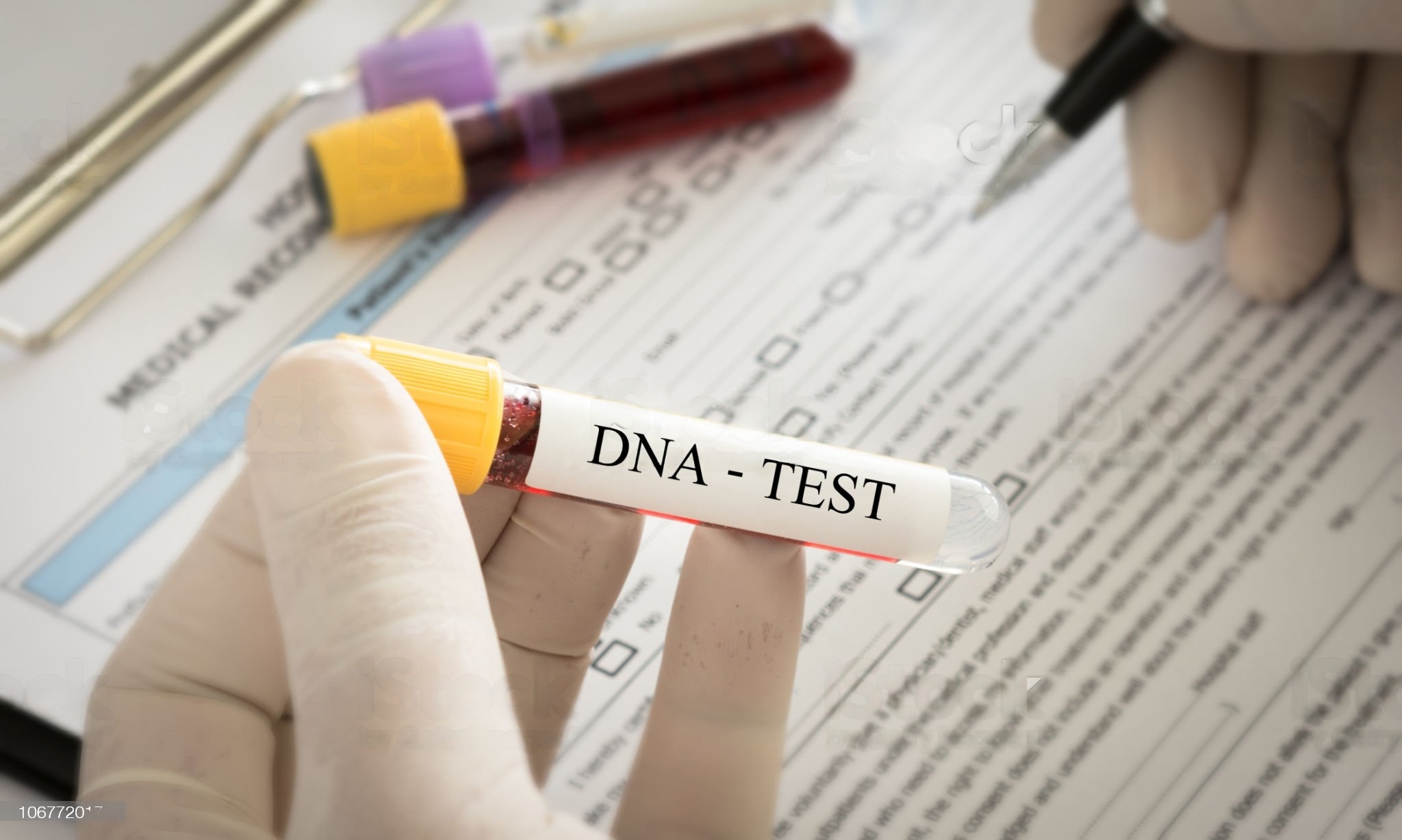 Berencana Tes DNA? Ini Estimasi Biayanya
