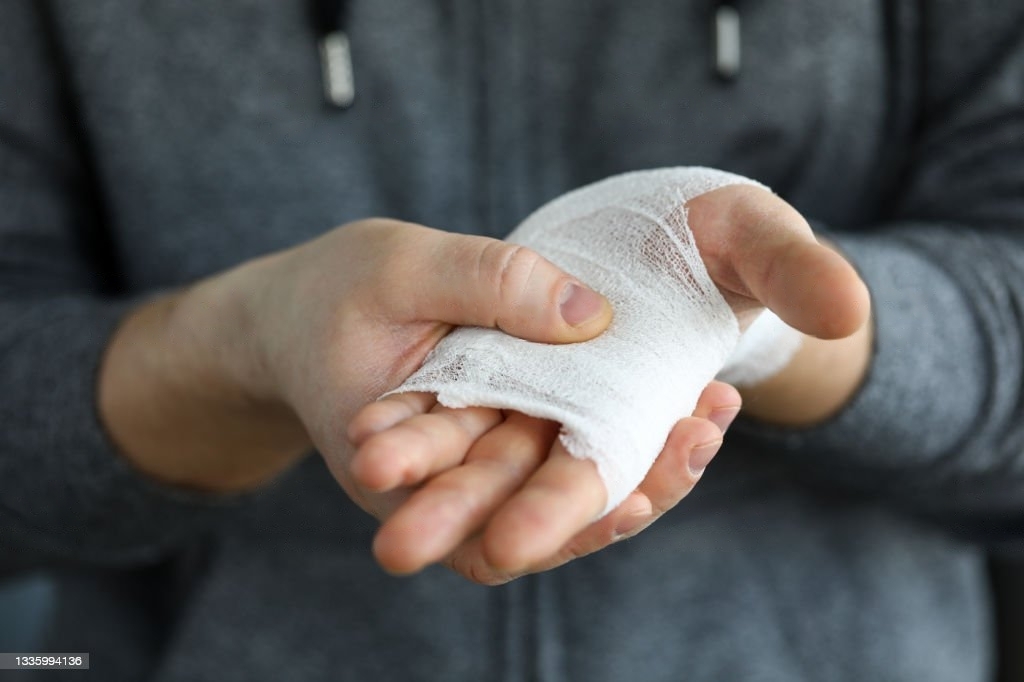 Tips dan Cara Pakai Perban Di Rumah