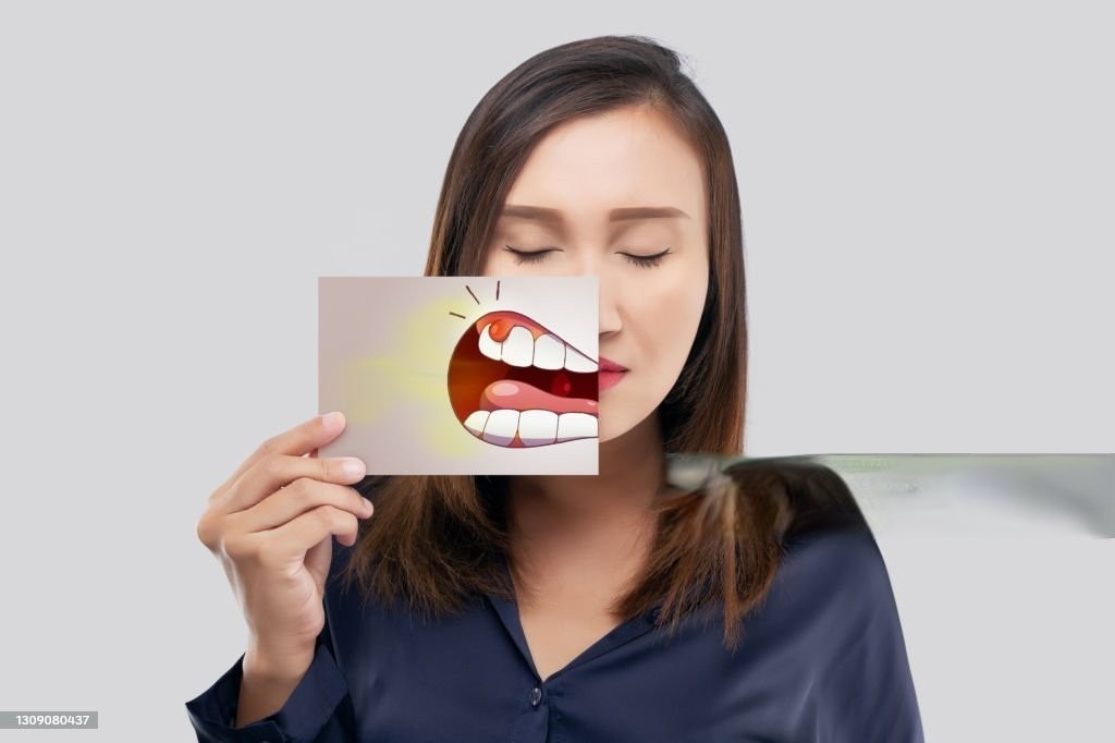 Senyum Sehat, Gusi Bahagia: Mencegah Gingivitis dengan Mudah