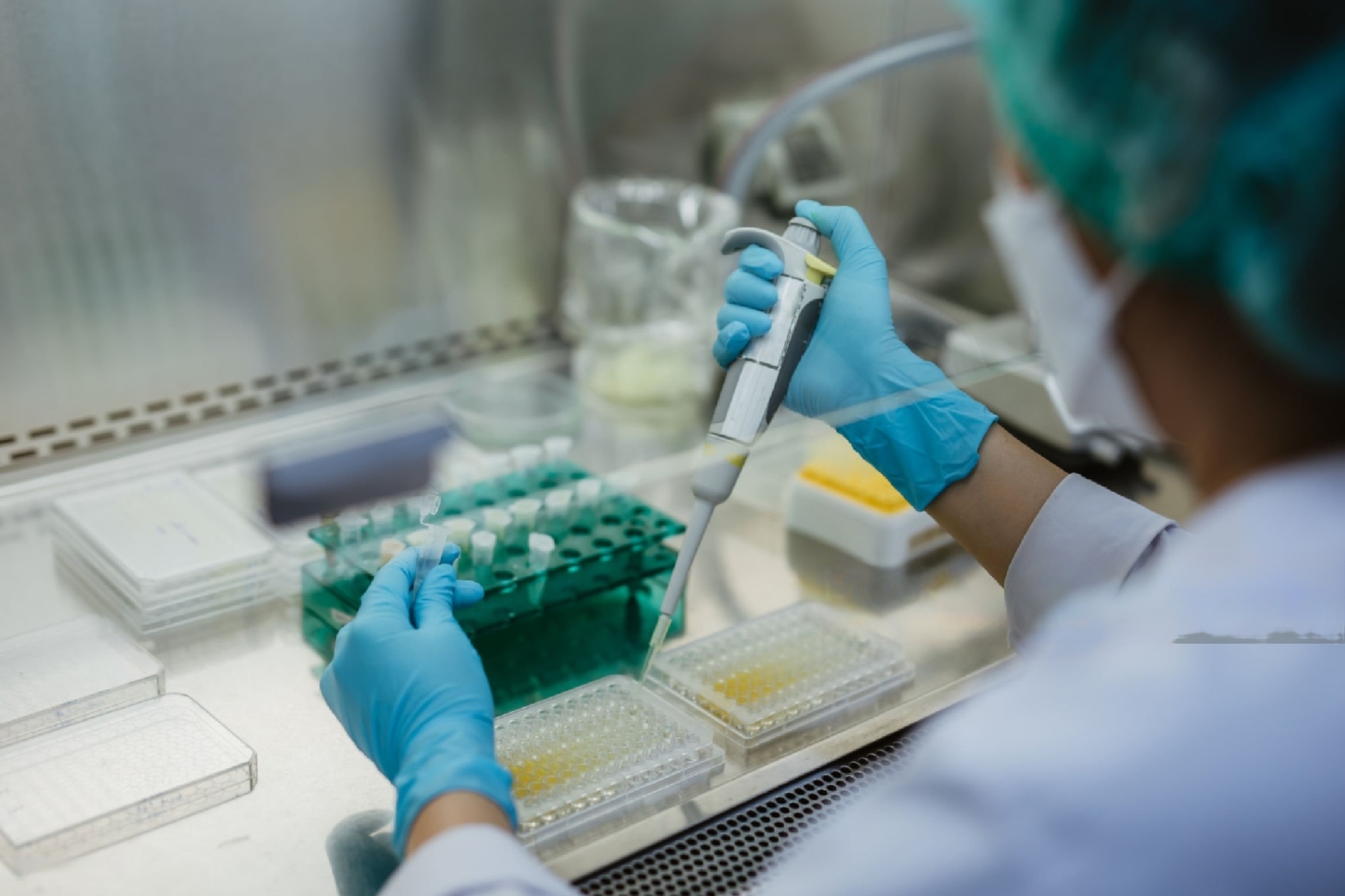 Prospek Karir Lulusan D3 Teknologi Laboratorium Medis