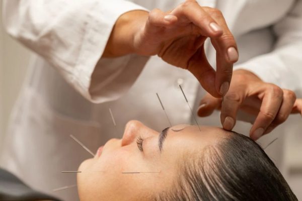 Pengobatan TCM: Dari Akupunktur Hingga Herbal