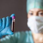 Fakta Hematologi dan Apa Saja Yang Dipelajari