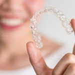 Range Harga Retainer Gigi Berdasarkan Jenisnya