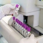 Apa Itu Teknik Laboratorium Medis dan Prospek Kerjanya