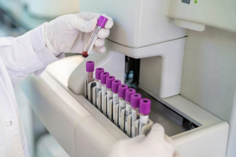 Apa Itu Teknik Laboratorium Medis dan Prospek Kerjanya